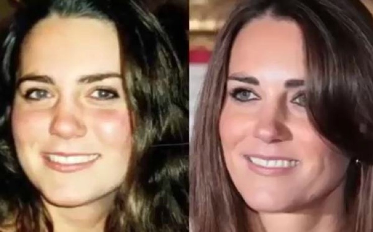 Il prima e il dopo di Kate Middleton - Youbee.it