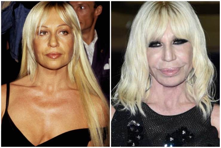 Il prima e il dopo di Donatella Versace - Youbee.it