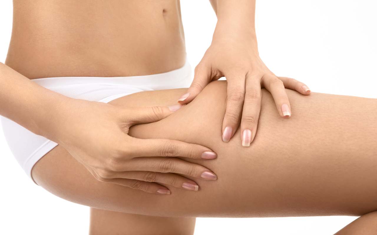 Rimedi per la cellulite